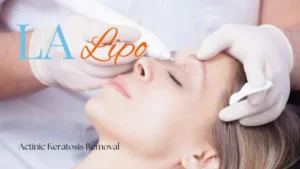 Woman receiving Actinic Keratosis Removal Treatment Lower Morden