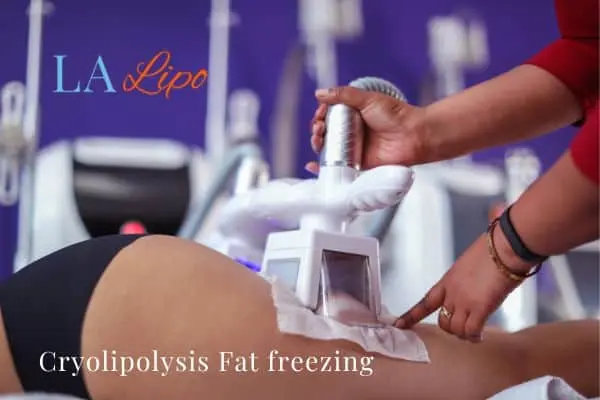 women getting fat freezing Lower Morden