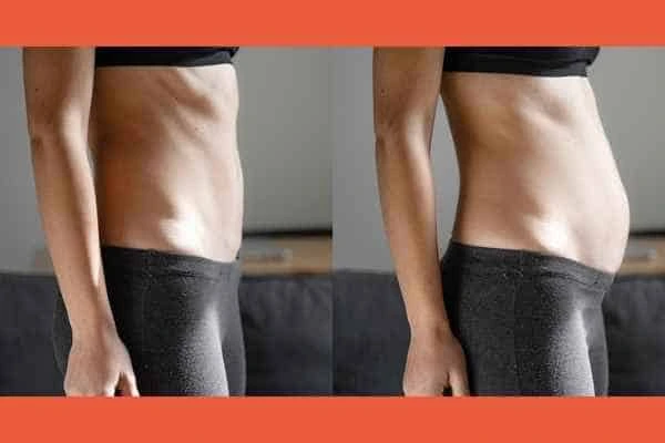 LA-EMS Body Sculpting results Lower Morden