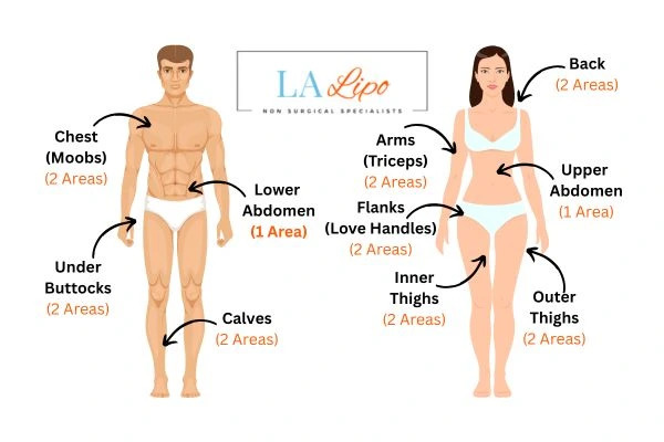 LA LIPO Cryolipolysis Areas Lower Morden