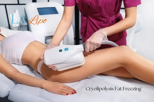Woman receiving coolsculpting Lower Morden treatment on her thighs