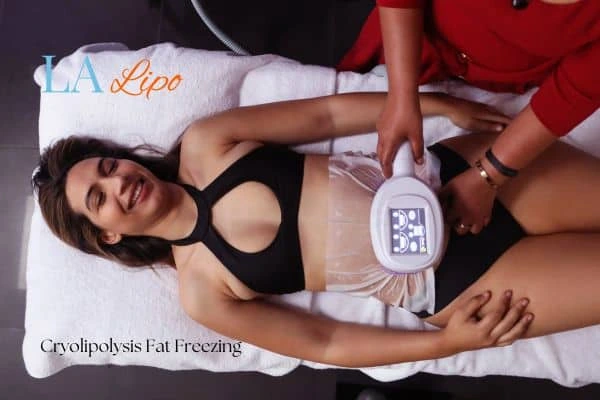 woman getting cryolipolysis Lower Morden