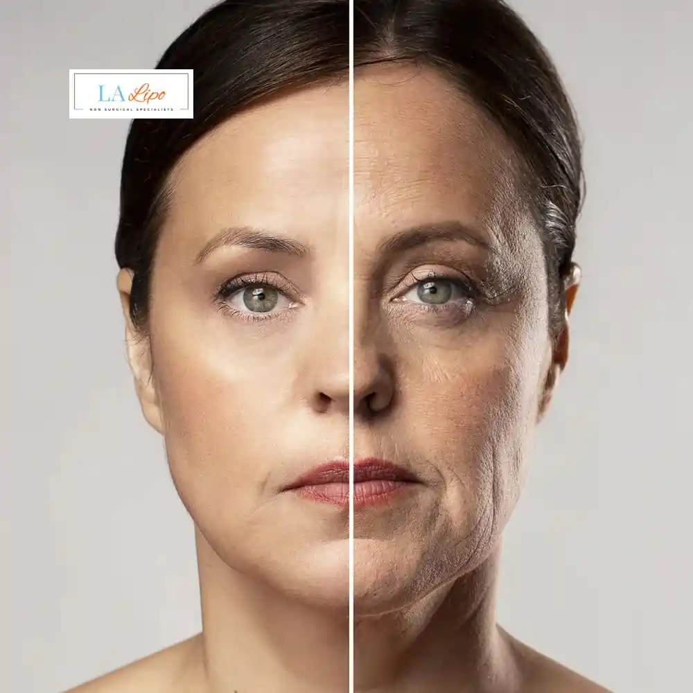 How Can You Tell If Non-Surgical Skin Tightening Is Right for You Lower Morden?
